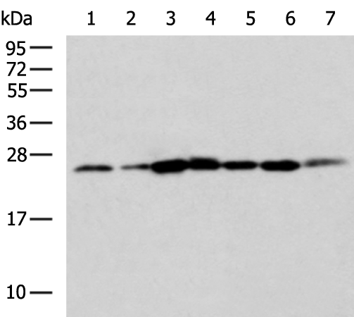 Rabbit Polyclonal Antibody to ELOVL5