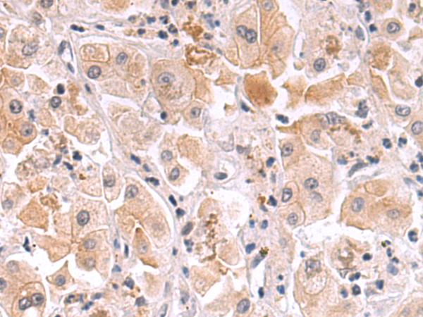 Rabbit Polyclonal Antibody to FLT1