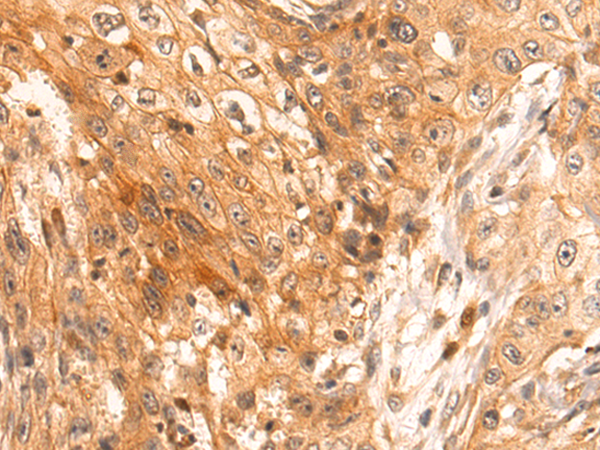 Rabbit Polyclonal Antibody to TRIM38