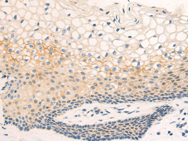 Rabbit Polyclonal Antibody to TNFSF9