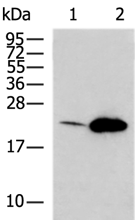 Rabbit Polyclonal Antibody to HRAS