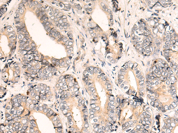 Rabbit Polyclonal Antibody to KRAS