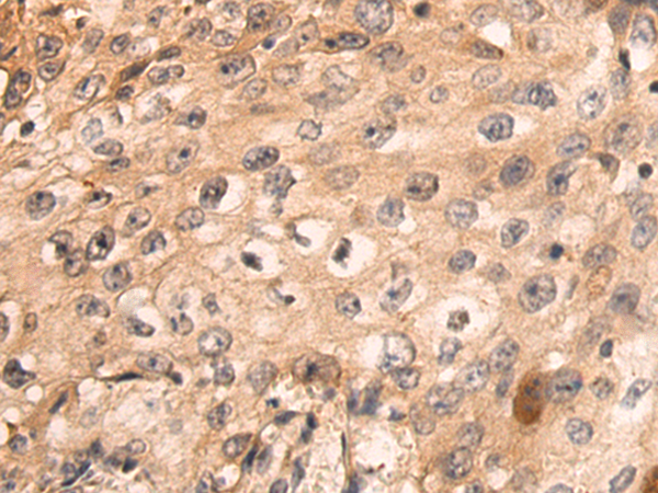 Rabbit Polyclonal Antibody to CYP24A1