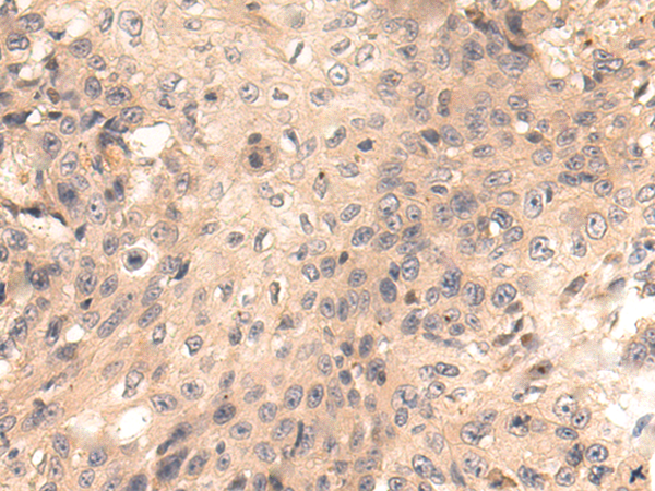 Rabbit Polyclonal Antibody to CTU1