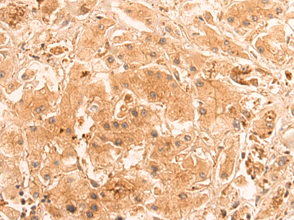 Rabbit Polyclonal Antibody to PNCK