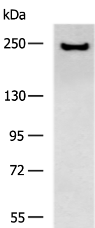 Rabbit Polyclonal Antibody to ACACA