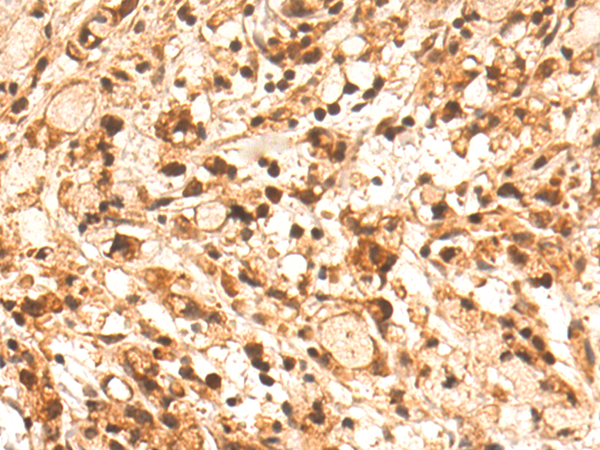 Rabbit Polyclonal Antibody to FGF13