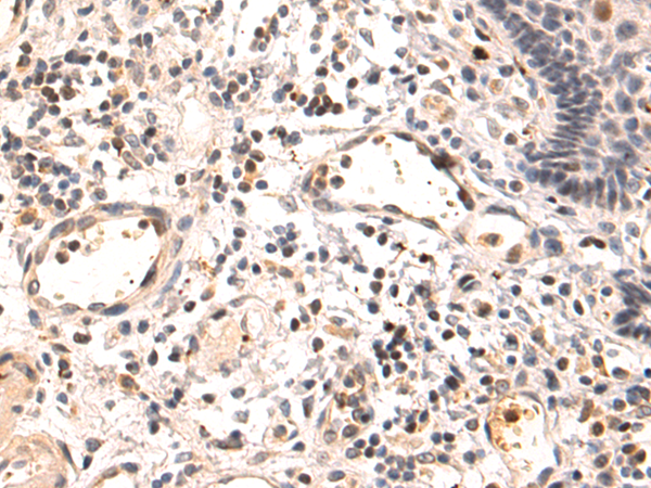 Rabbit Polyclonal Antibody to PPP2R3B