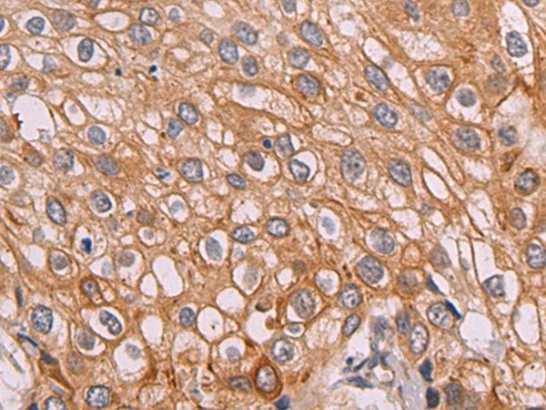 Rabbit Polyclonal Antibody to CD52