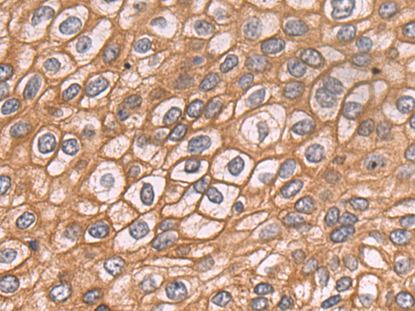 Rabbit Polyclonal Antibody to COL5A1