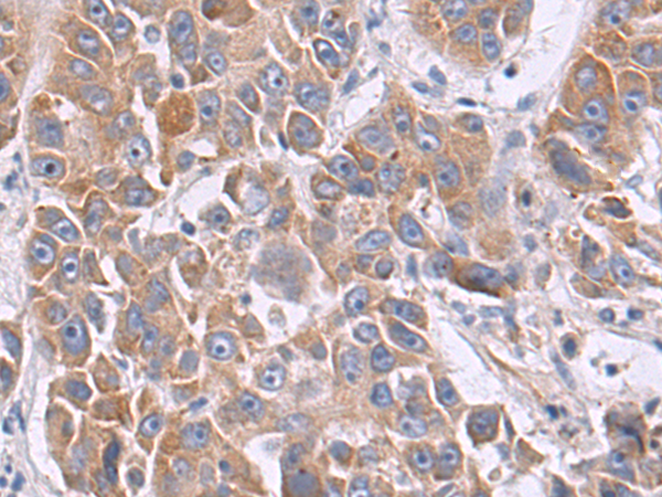 Rabbit Polyclonal Antibody to CIB2