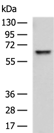 Rabbit Polyclonal Antibody to HEXB