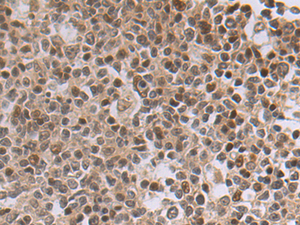 Rabbit Polyclonal Antibody to MXD4
