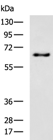Rabbit Polyclonal Antibody to TGFBR2