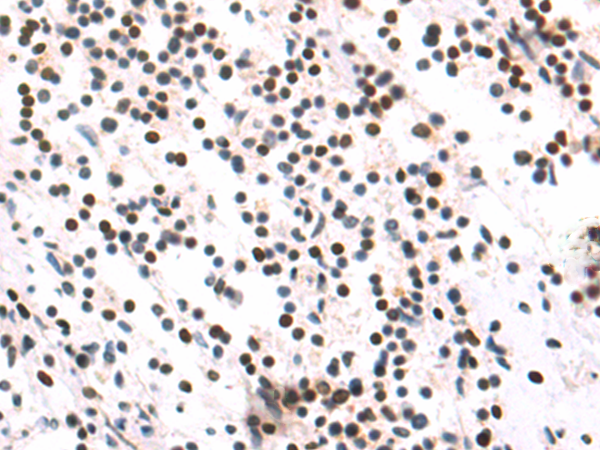 Rabbit Polyclonal Antibody to NUMA1