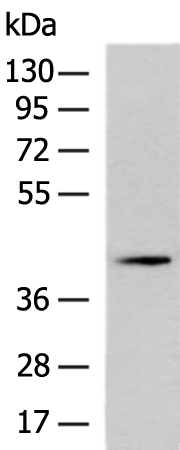 Rabbit Polyclonal Antibody to PRKACB