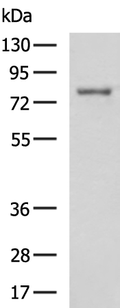 Rabbit Polyclonal Antibody to CAMK2B