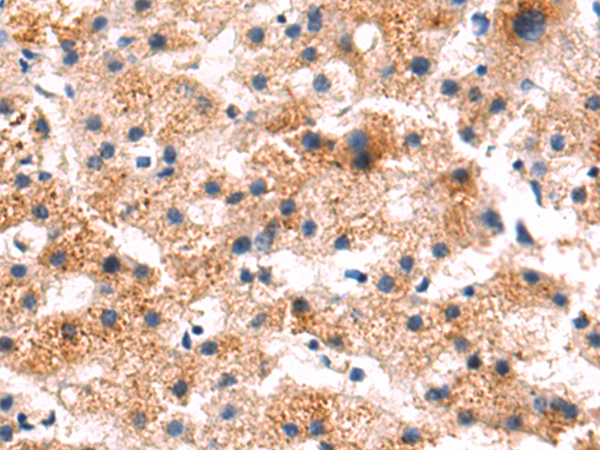 Rabbit Polyclonal Antibody to CYP8B1