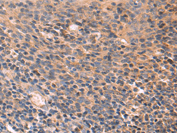 Rabbit Polyclonal Antibody to ACP5