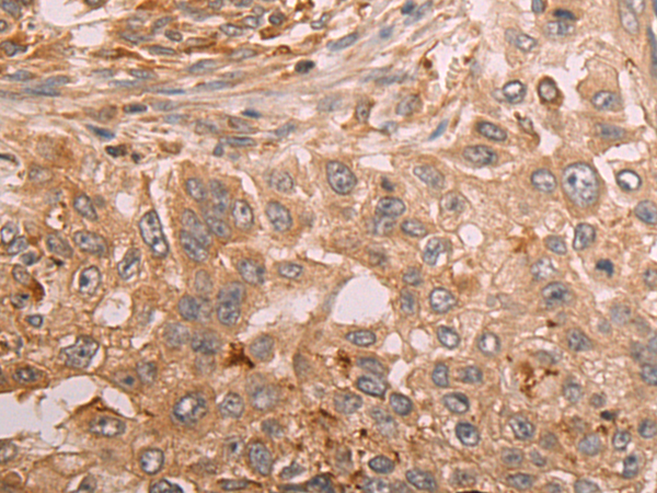 Rabbit Polyclonal Antibody to CLDN6