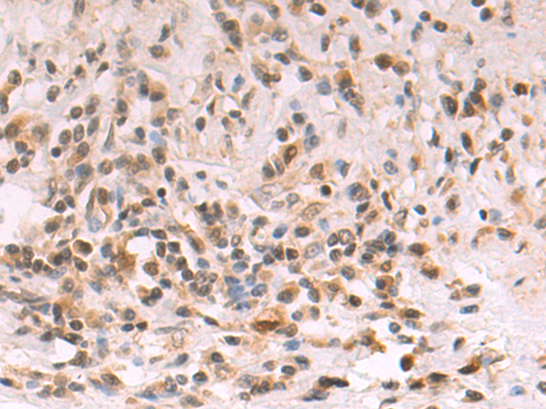 Rabbit Polyclonal Antibody to HOXA1