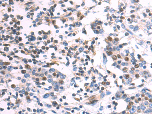 Rabbit Polyclonal Antibody to PIAS3