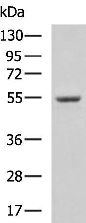 Rabbit Polyclonal Antibody to ETV1