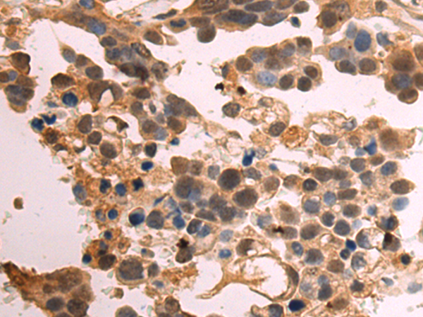 Rabbit Polyclonal Antibody to PARP2