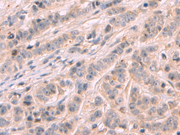 Rabbit Polyclonal Antibody to NNMT
