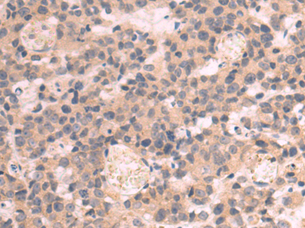 Rabbit Polyclonal Antibody to SLC35B1