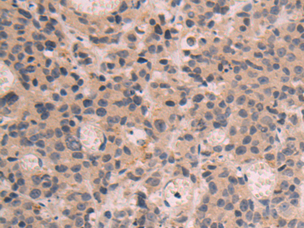 Rabbit Polyclonal Antibody to SLC25A39