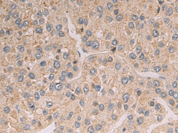 Rabbit Polyclonal Antibody to SLC22A7