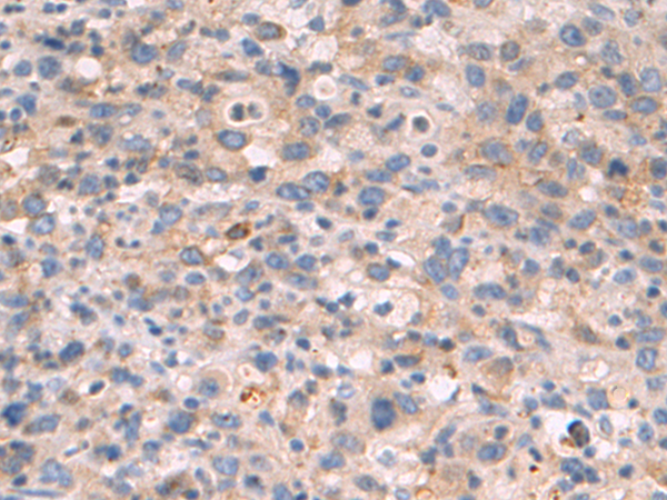 Rabbit Polyclonal Antibody to SPINK1