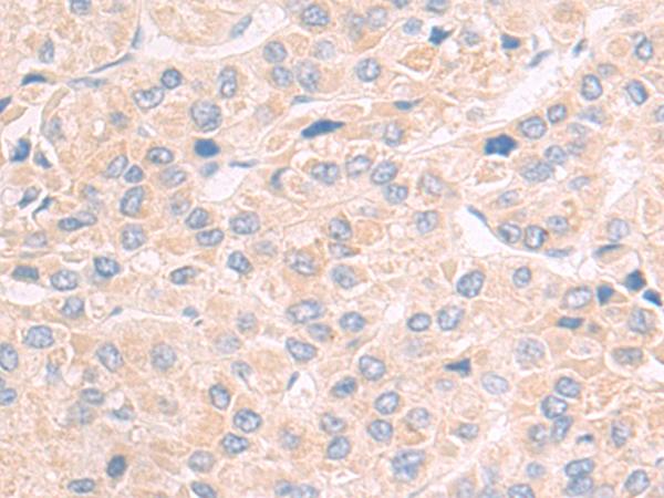 Rabbit Polyclonal Antibody to ANGPTL2