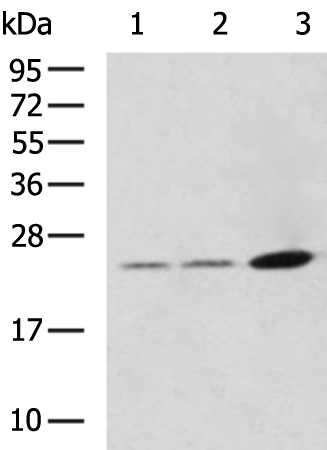Rabbit Polyclonal Antibody to KLK15