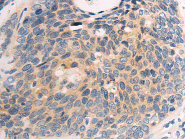 Rabbit Polyclonal Antibody to NTF3