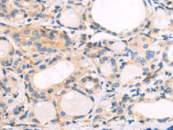 Rabbit Polyclonal Antibody to YWHAH