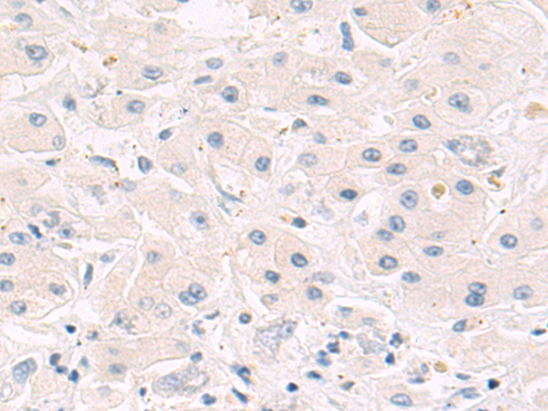 Rabbit Polyclonal Antibody to PRKN