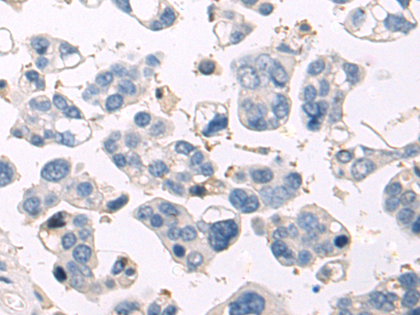 Rabbit Polyclonal Antibody to LAMA2