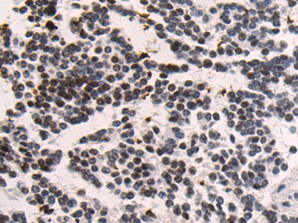 Rabbit Polyclonal Antibody to CHD4