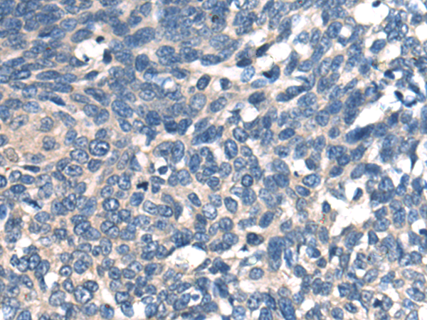 Rabbit Polyclonal Antibody to PLCE1