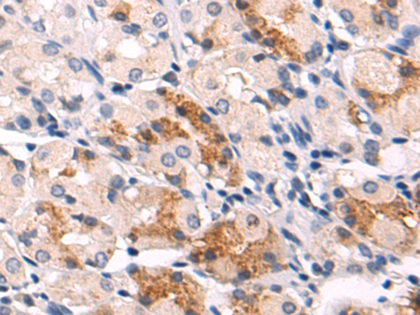 Rabbit Polyclonal Antibody to YOD1