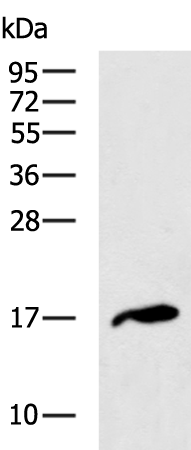 Rabbit Polyclonal Antibody to CDKN2B
