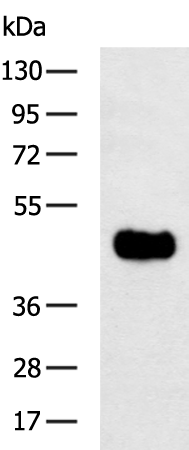 Rabbit Polyclonal Antibody to CTSD