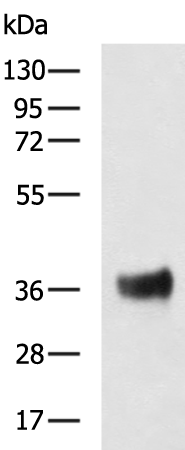 Rabbit Polyclonal Antibody to FOLR1
