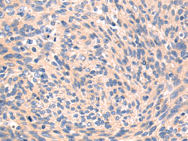 Rabbit Polyclonal Antibody to DOK7