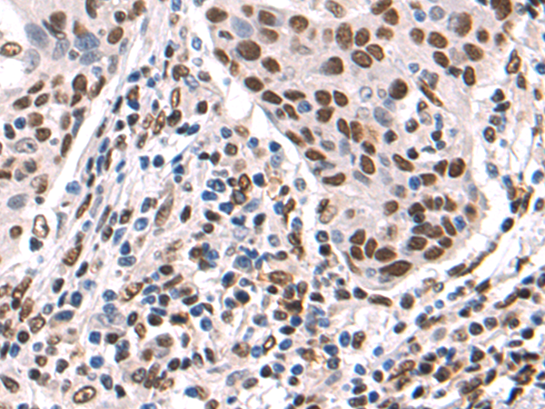 Rabbit Polyclonal Antibody to SYNCRIP