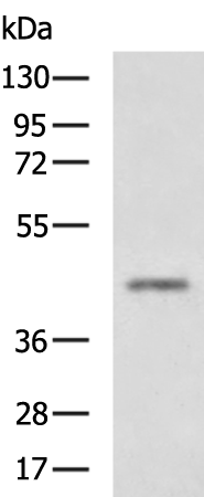 Rabbit Polyclonal Antibody to MAGEA4