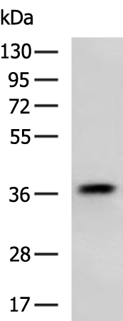 Rabbit Polyclonal Antibody to ANXA8