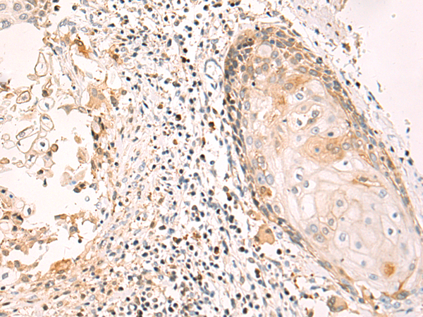 Rabbit Polyclonal Antibody to TNFRSF12A